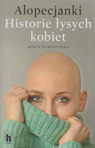 Alopecjanki : historie łysych kobiet